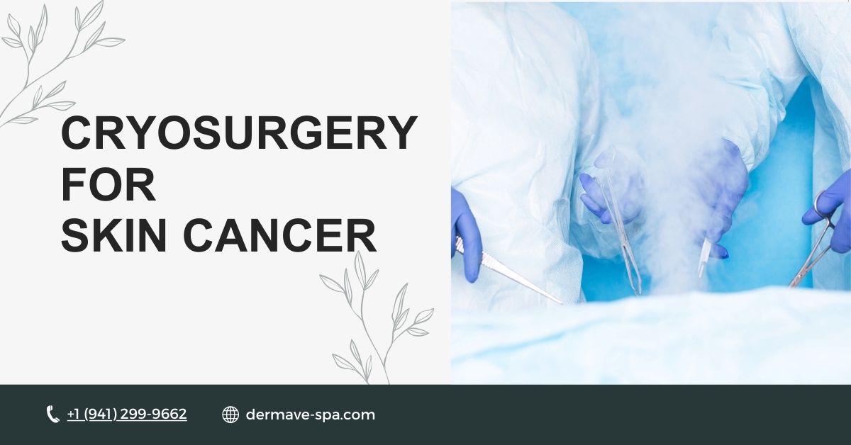 Cryosurgery for Skin Cancer